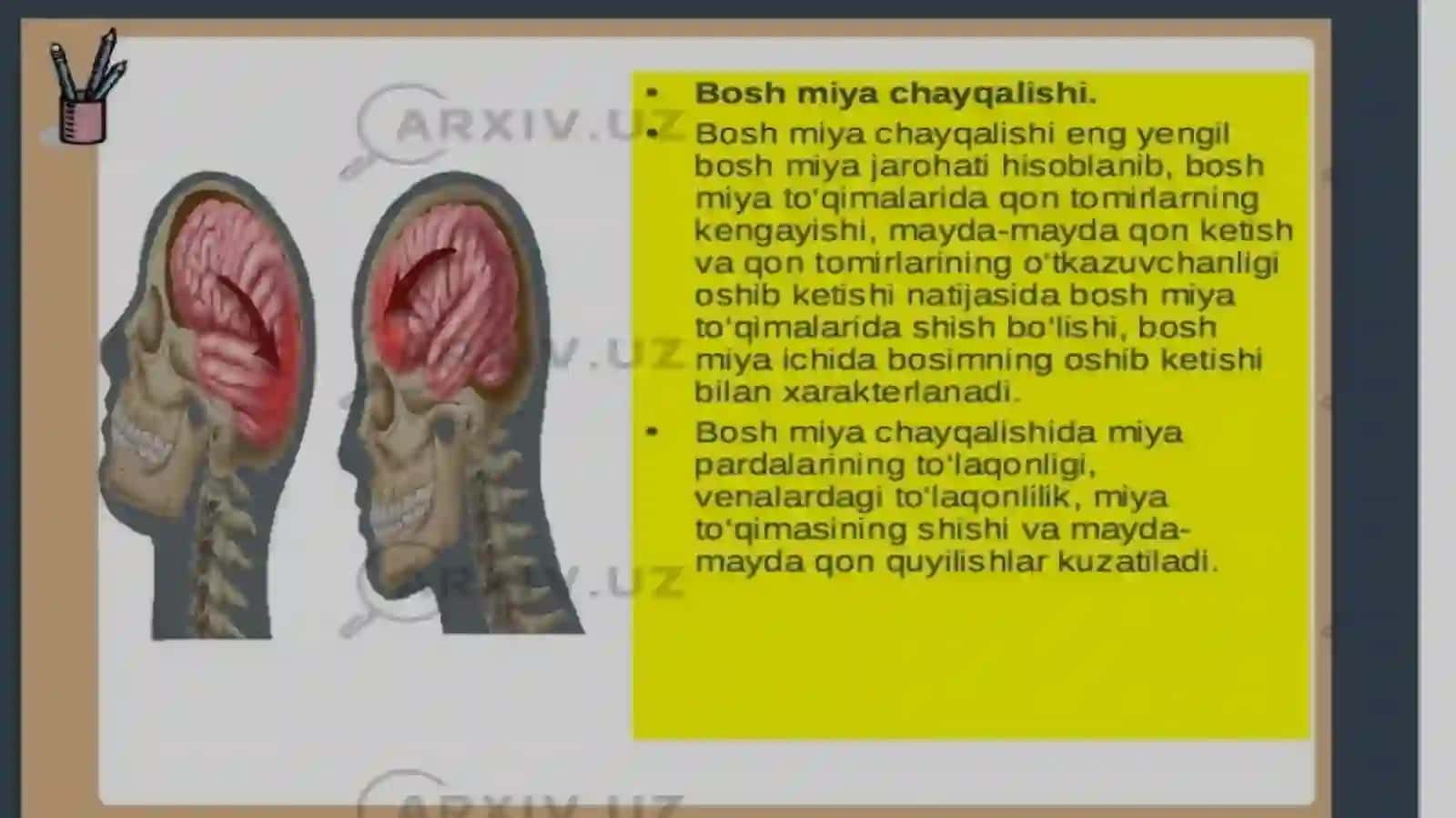 Bosh miya shikastlanishlari. 4