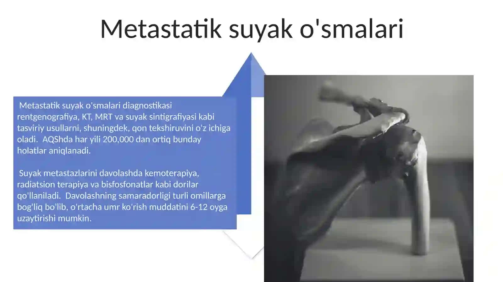 Suyak o‘sma kasalliklari 4