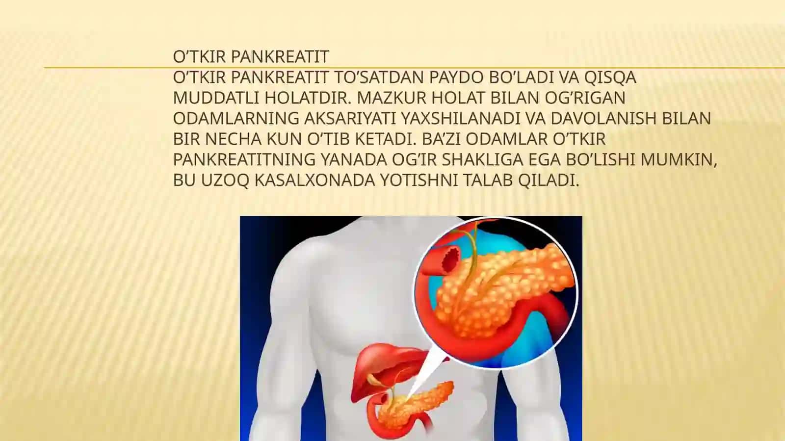Pankreatitlarda xirurgik davolash usullari 4