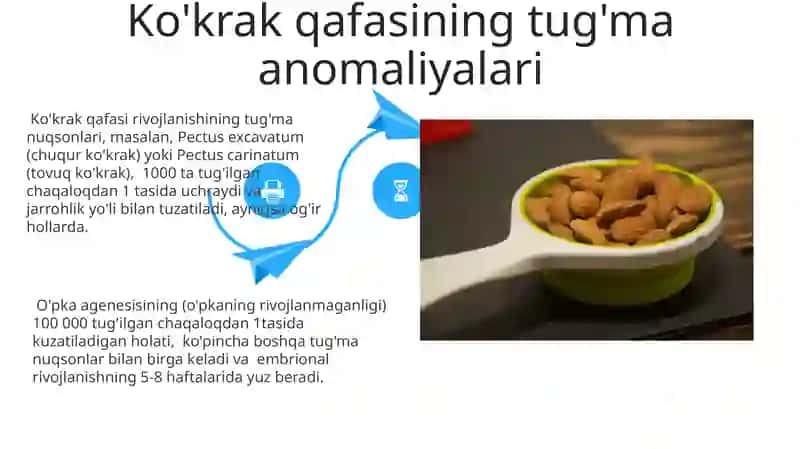 Ko'krak qafasining tugʻma va olingan anamaliyalari 4