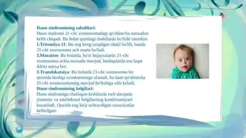 “DAUN SINDROMI” MAVZUSIDA TAYYORLAGAN TAQDIMOT 4