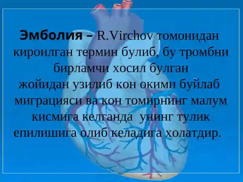 Ўткир артериал тромбози ва эмболиялари 4