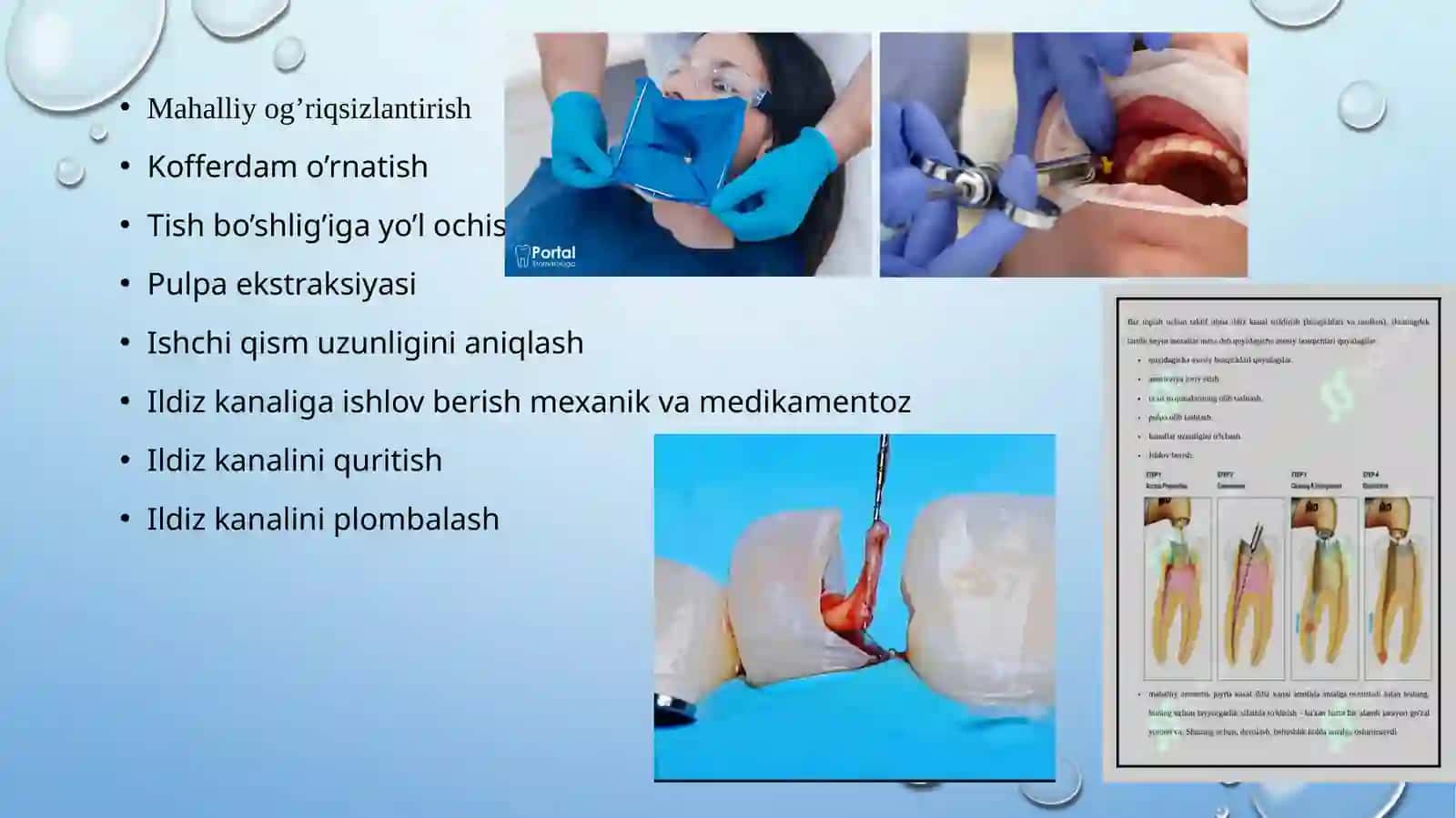 Ildiz kanal o'zini kengaytiruvchi asboblar 4