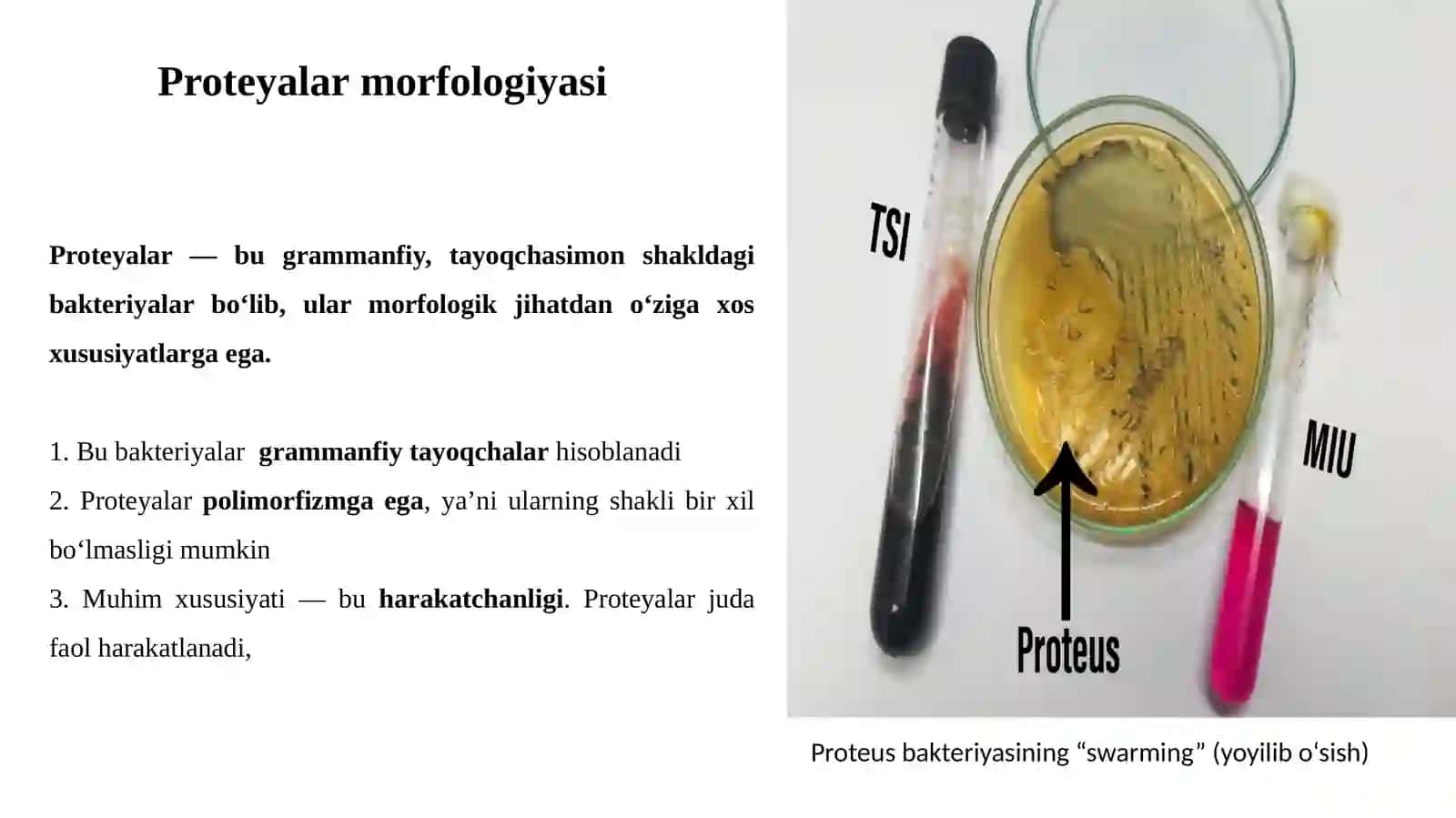Ichak guruhi bakteriyalarining seroidentifikatsiyasi 4