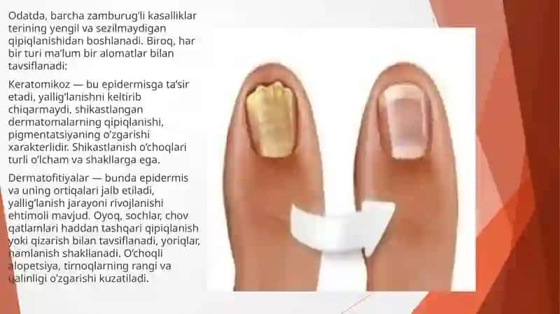Chuqur mikozlar, mikozlar 4