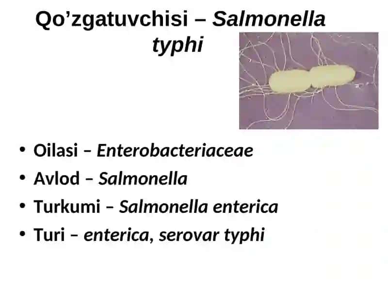 TIFOPARATIFOZ KASALLIKLAR 4