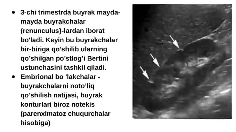 Ultratovush tekshirish usuli - Sоnоgrafiya 4