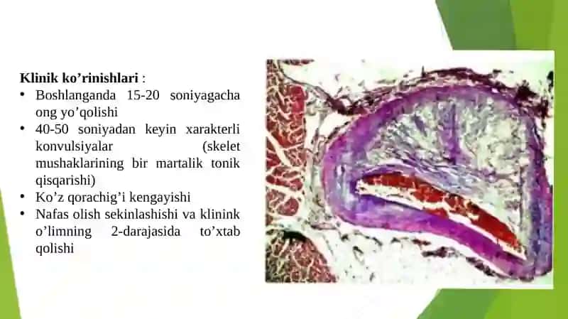 Tasodifiy Yurakdan O'lim Sindromi 4