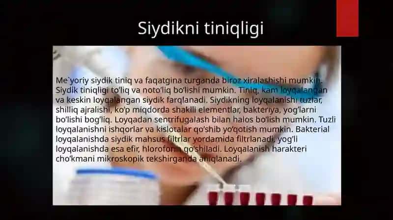 Siydikniyig’ish 4