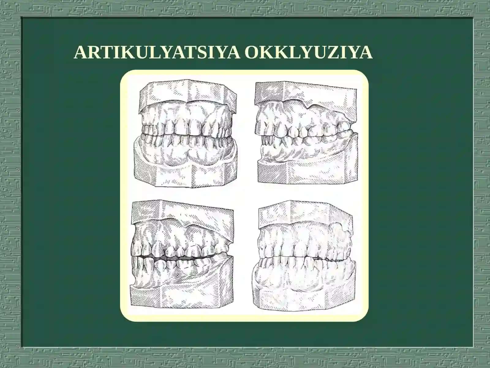 ARTIKULYATSIYA VA OKKLYUZIYA 4