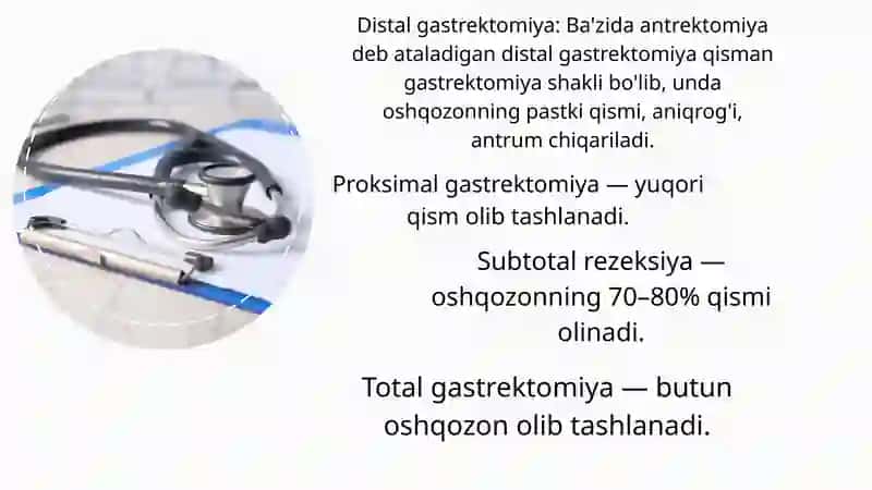Oshqozon rezeksiyasi 4