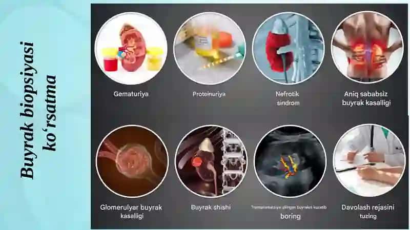 Buyrak biopsiyasi 4