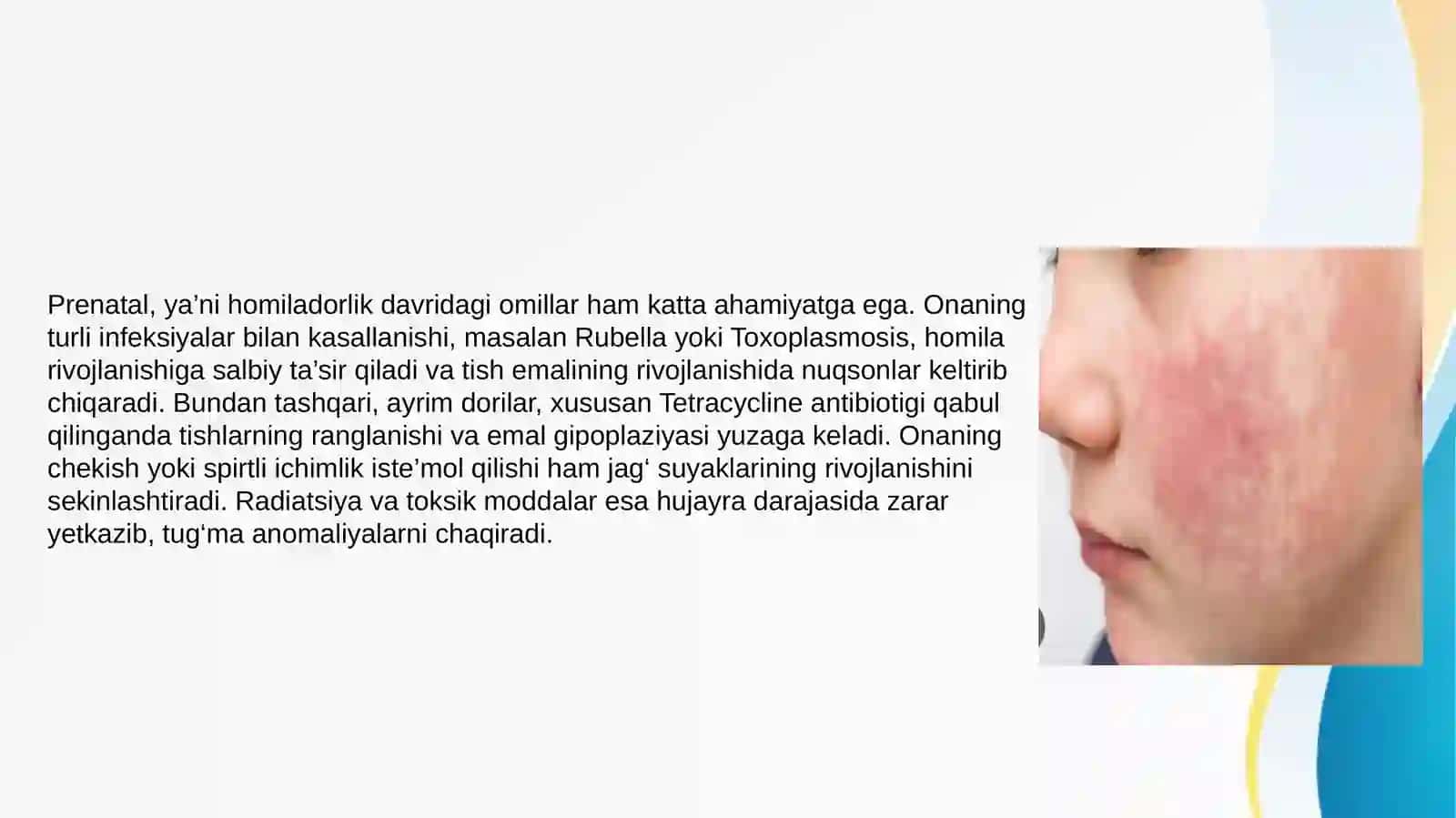 Bolalar stomotologiyasidsa anomaliya va deformatsiyalar rivojlanishida zararli odatlar 4