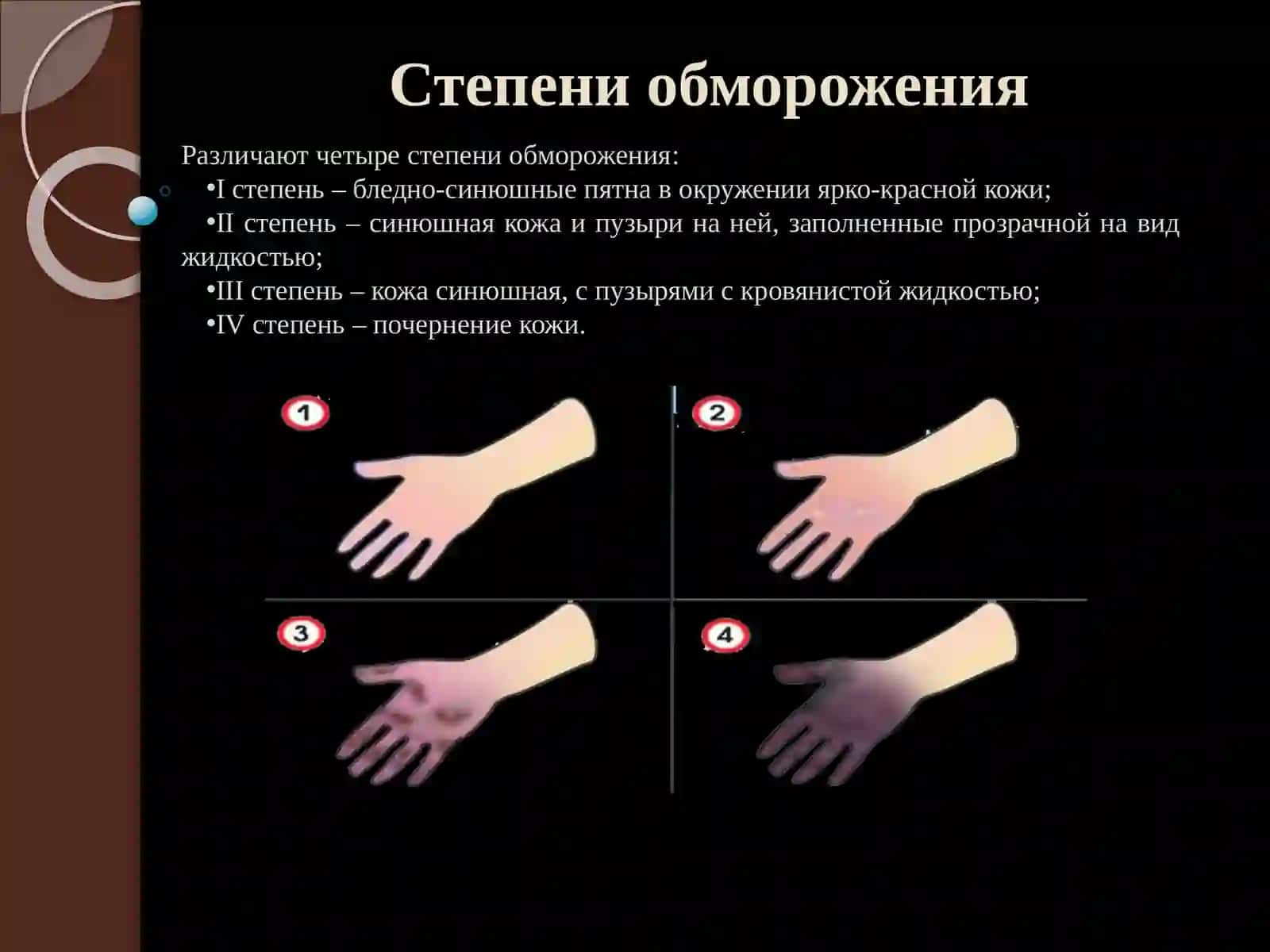 Первая медицинская помощь при различных несчастных случаях. Часть 2 4