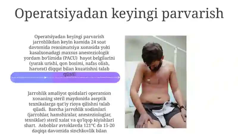 Xirurgik operatsiyalarni o'tkazish qoidalari 4