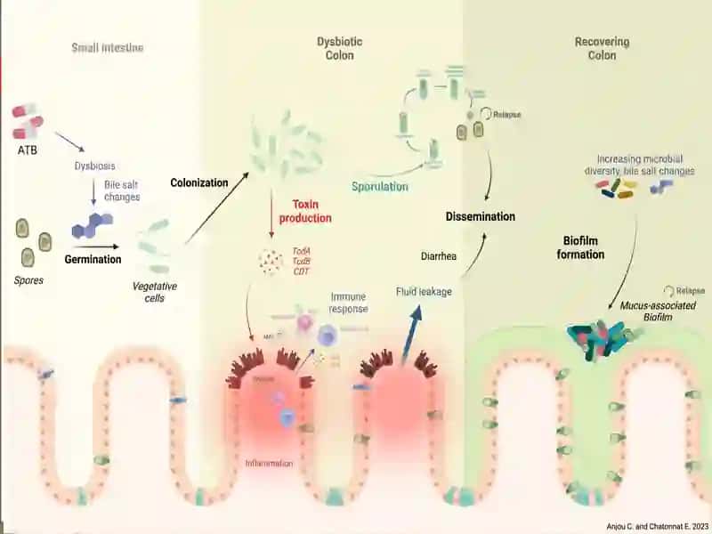 Shartlipatogen anaerob kokklar 4