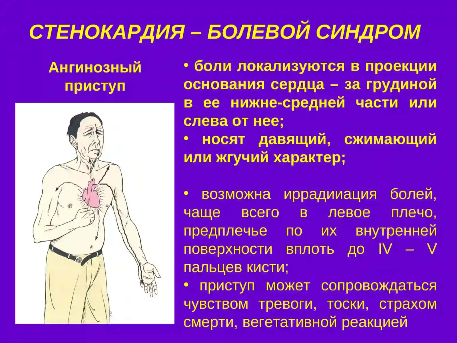 ИШЕМИЧЕСКАЯ БОЛЕЗНЬ СЕРДЦА 4
