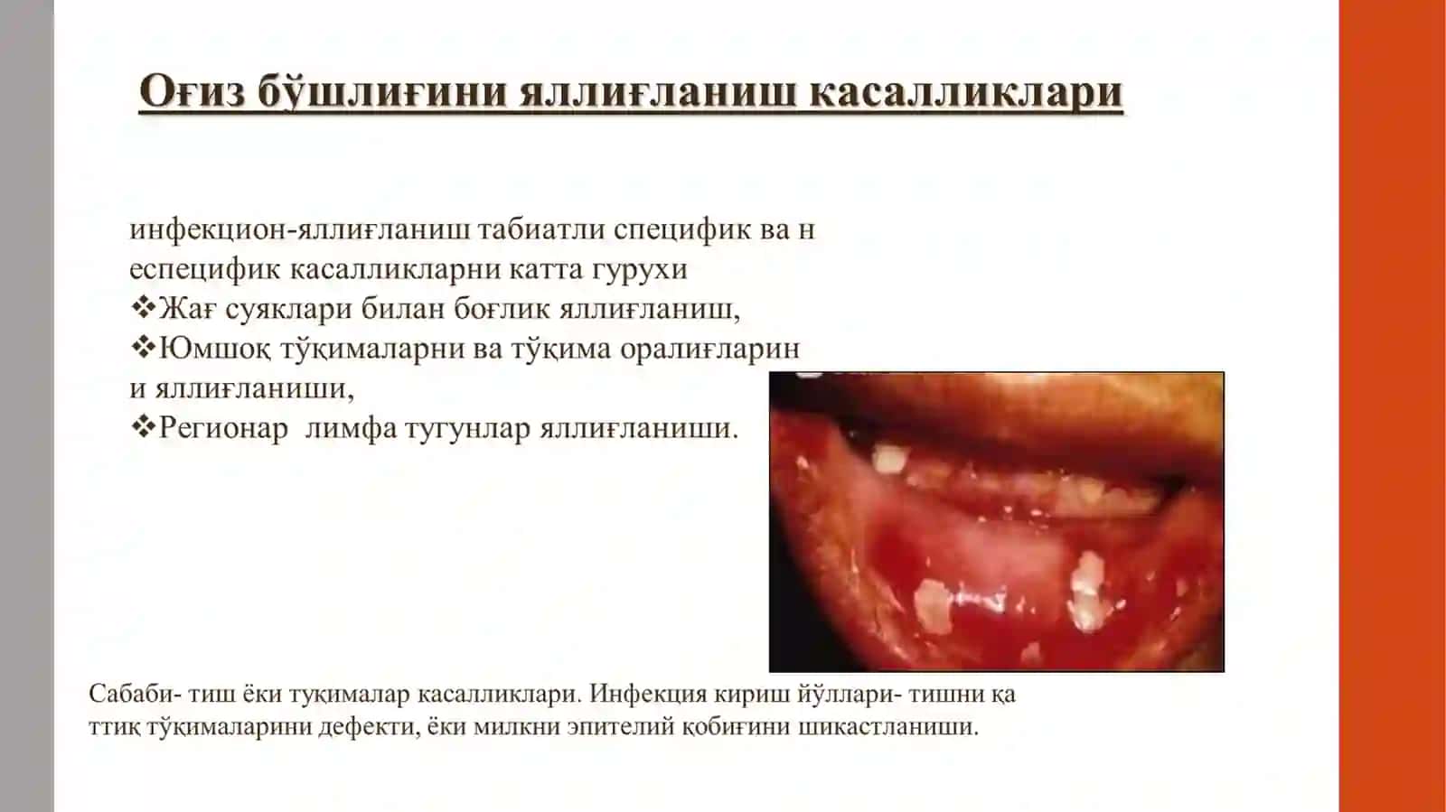 Мирзакаримова Еркин ўқитувчиларига огиз бушлиги патофизиологияси 4