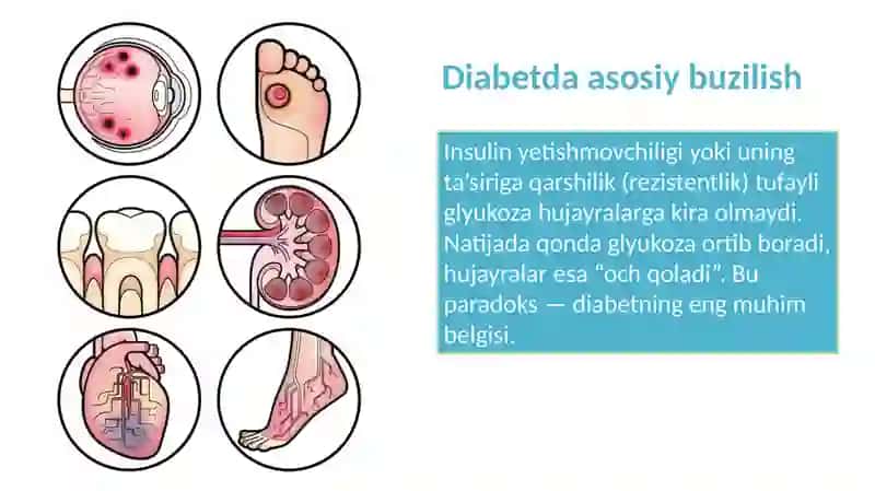 Qandli diabet va uning asoratlarini kelib chiqishida karbonsuvlar almashinuvi buzulishi 4