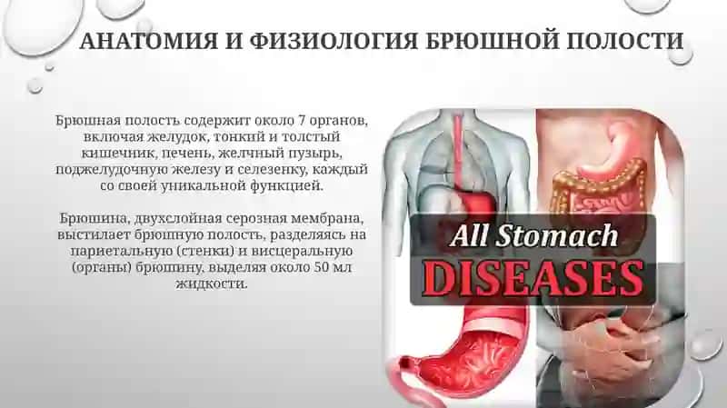 Заболевания брюшной полости 4