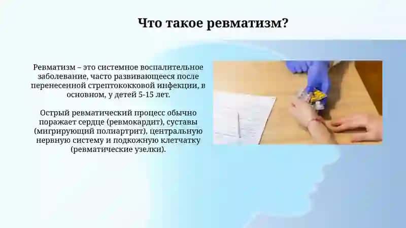 Особо опасные инфекции. Рекомендации врача при ревматизме. Ролевая игра «На приёме у врача» 4
