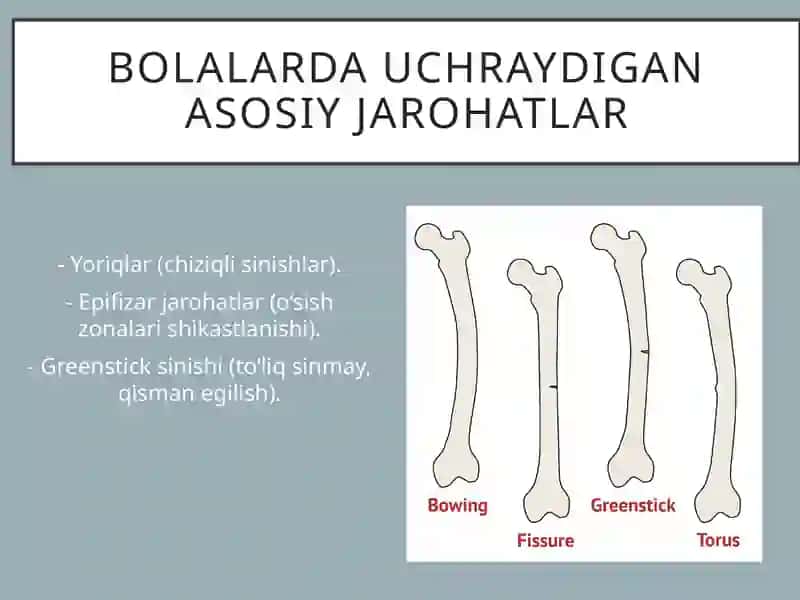 Bolalarda O‘ziga Xos Jarohatlanish 4