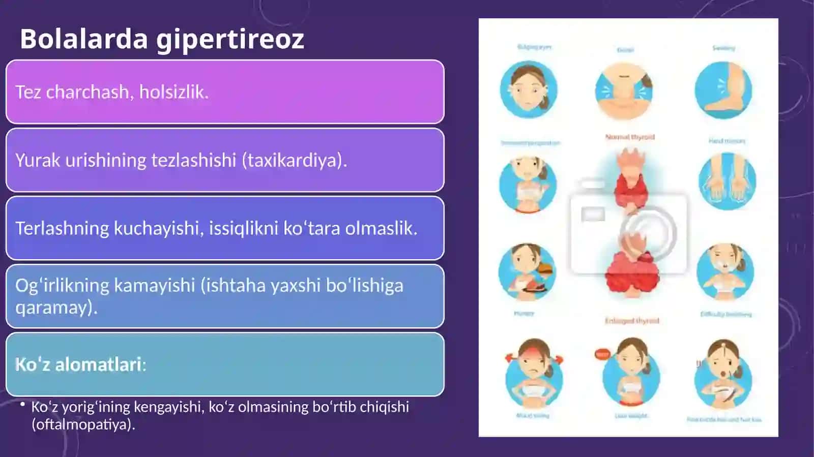 Gipertireoz va uning bolalarda nerv-psixik rivojlanishdagi ahamiyati. 4