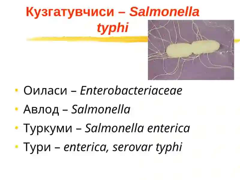 Ич терлама –қорин тифи (typhus abdominalis) 4