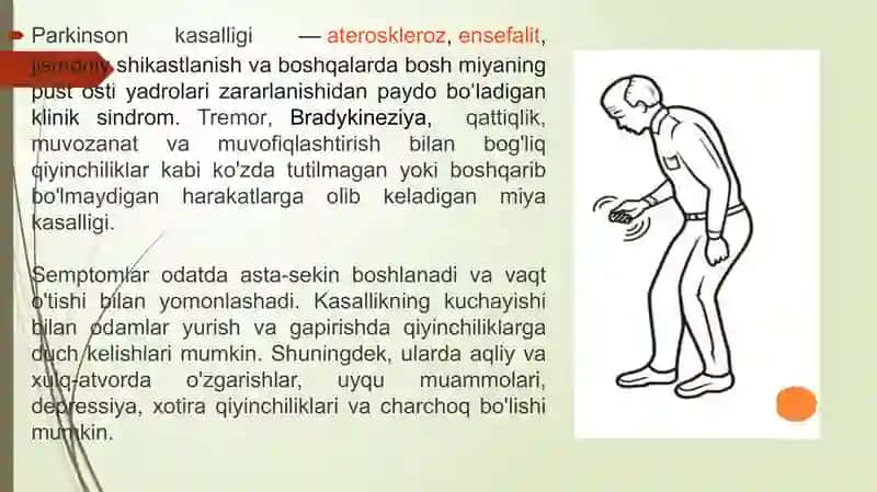 Parkinson kasalligi 4