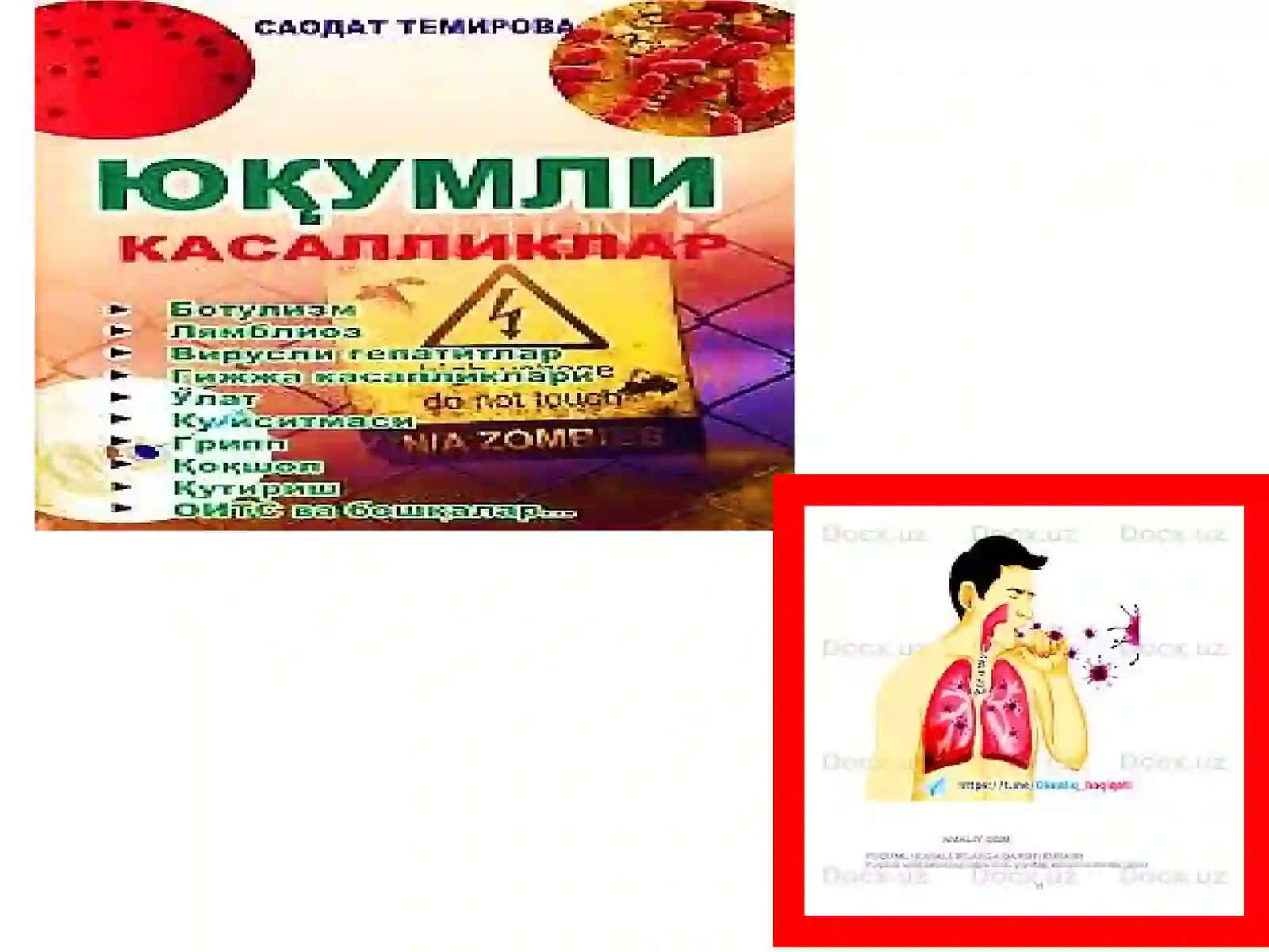 IminoblokPSR va Radioimun Reaktsiyalarining Qo‘llanilishi 4