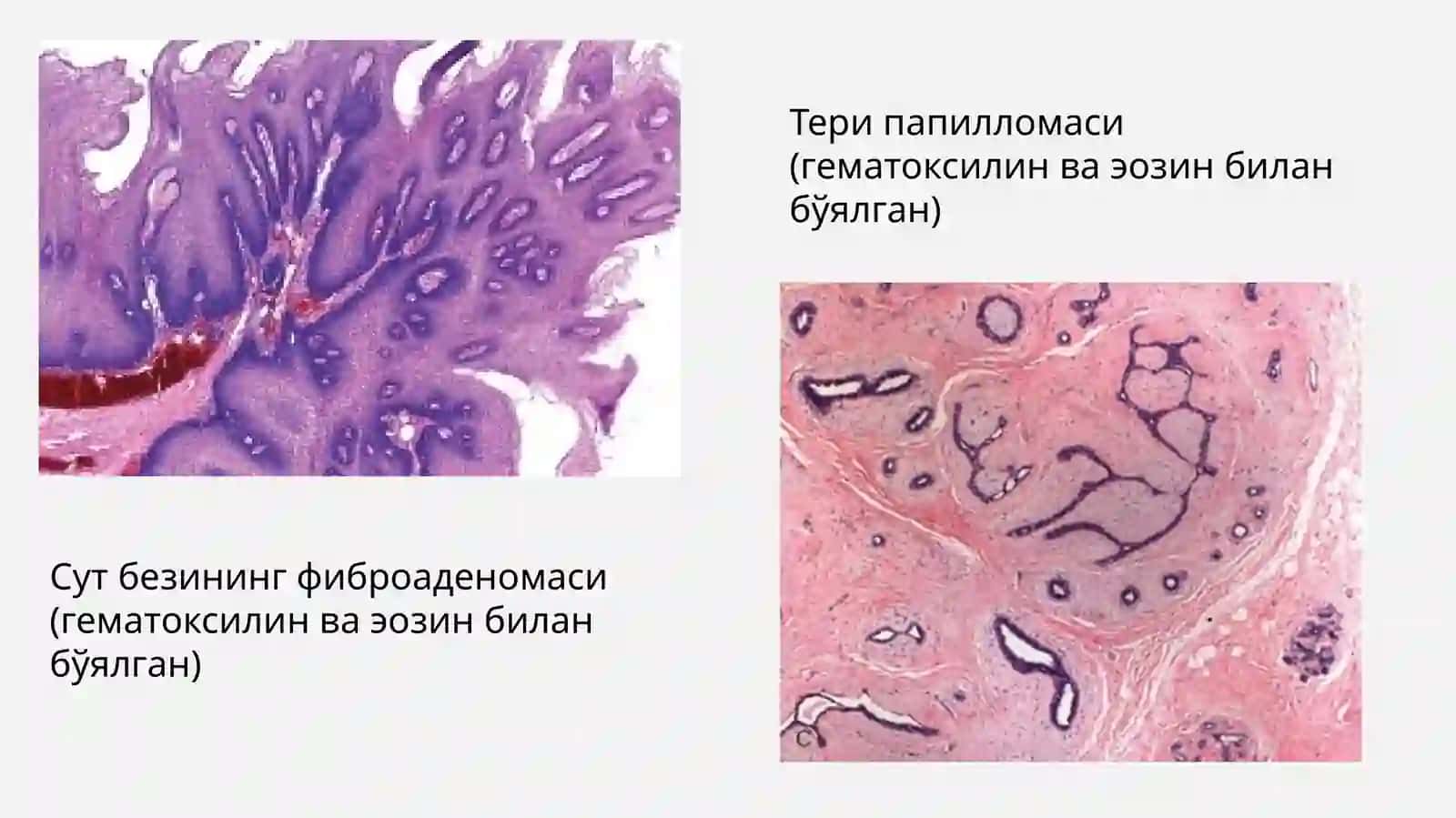 ONKOVIRUSLAR,ULARNIG TARQALISH YO’LLARI, O’SMA HOSIL QILUVCHI TA’SIRI. KANSEROGENEZ, UNDA HUJAYRA ONKOGENLARINING AHAMIYATI 4