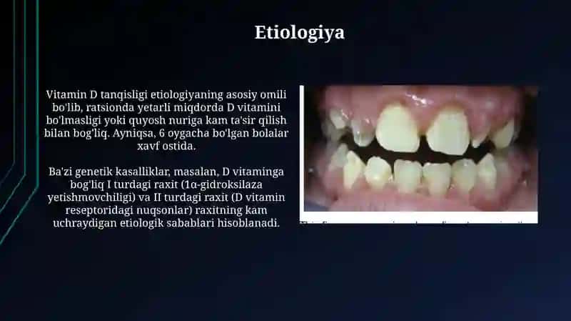 Chakka suyagi va uning bolalardagi xususiyati 4