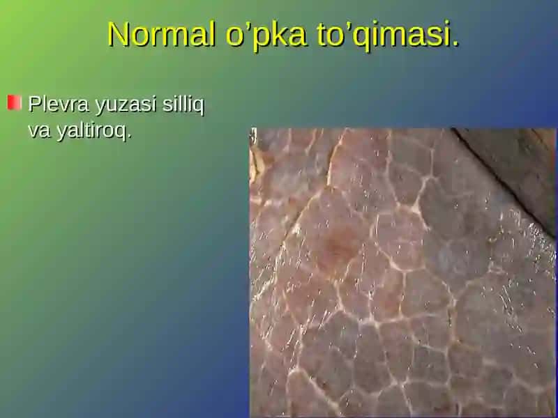 SOMATIK PATOLOGIYAVA OG‘IZ BO‘SHLIG‘IDAGI O‘ZGARISHLAR 4