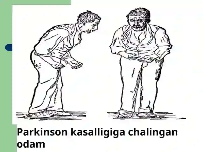 Parkinson kasalligini davolash 4