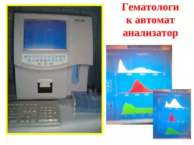 Қон клиник таҳлили ва унинг диагностик аҳамияти 4