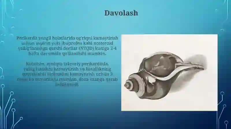 Perikarditlar 4