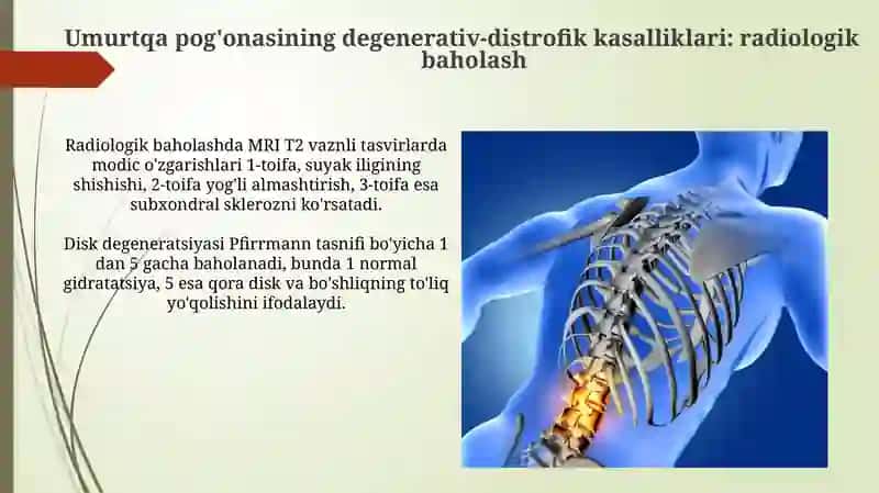 Umurtqa yalligʻlanish va degenerativ- distrofik kasalliklari ( radiologiya faniga oid) 4