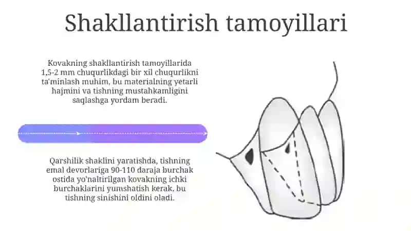 Stomatologiyada V.G blek boyicha 1 sinf kovak tayyorlashning oʻziga xosligi 4