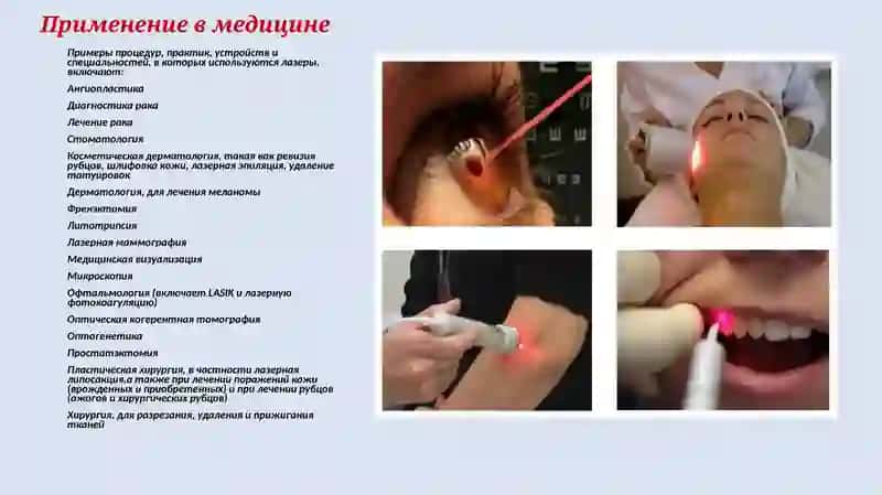 Лазеры в медицине 4