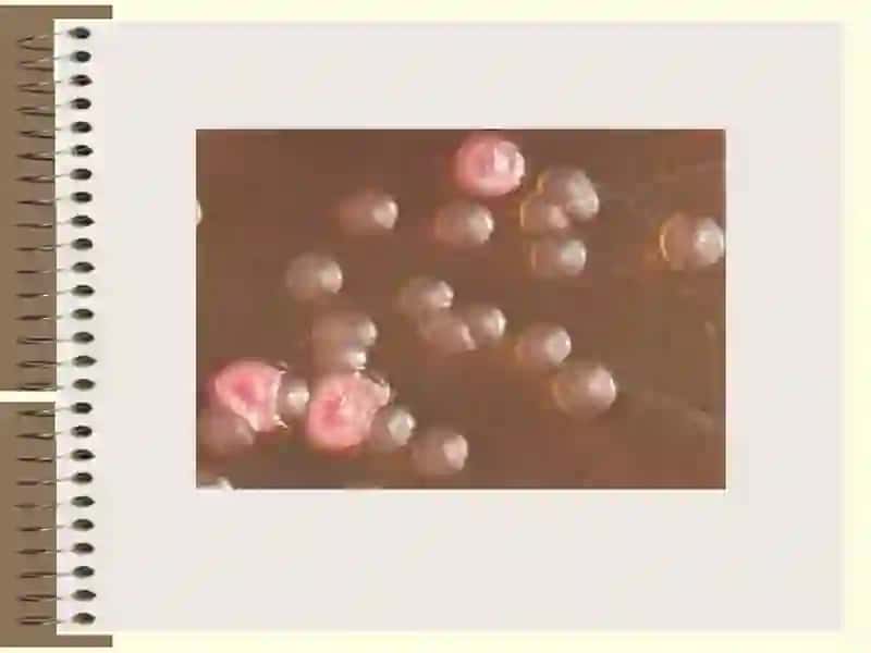 Causative agents of Shigellosis 4