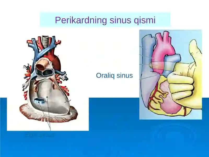 Perikard kasalliklari.Yurak o'smalari. Yurak trasplantologiyasi 4