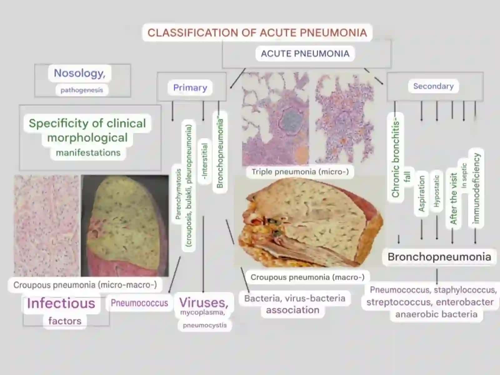 Lung diseases 4