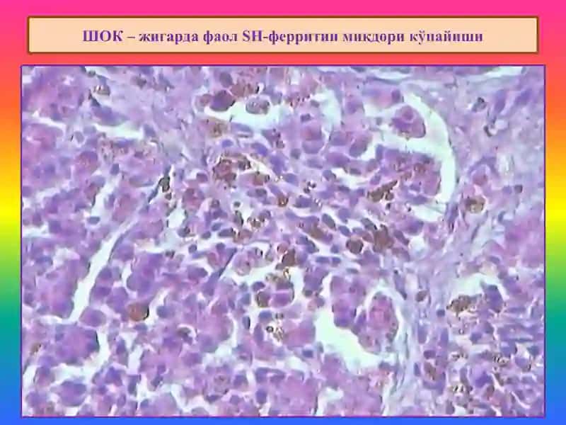 Аралаш дистрофиялар 4