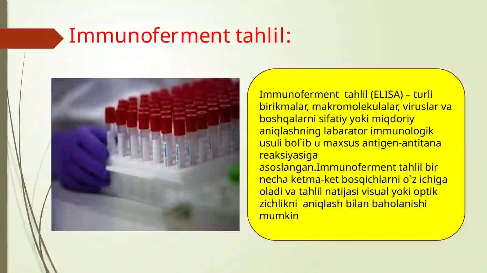 Serologik tekshiruvning immunoferment tahlil usuli 4