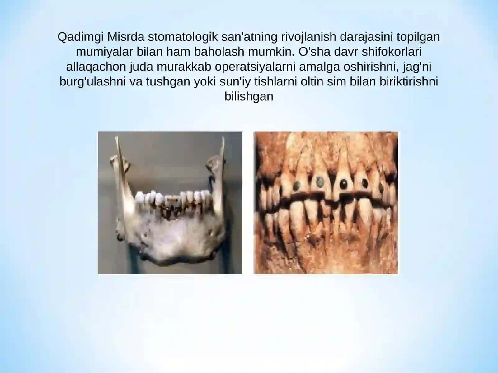 Stomatologiya rivojlanishi 4