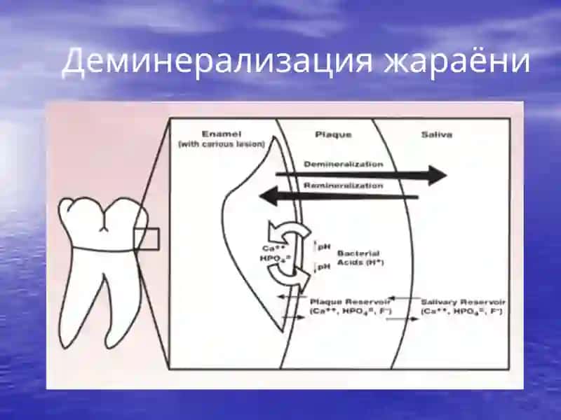 Кариесепидимиологияси 4