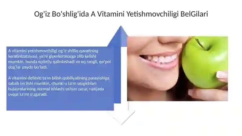 Gipovitaminozlar: Ta'rif, Tasnif va Og'iz Bo'shlig'idagi Namoyonlari 4