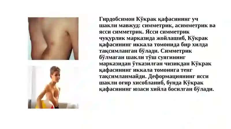 Кўкрак қафаси ва ўпканинг туғма ривожланиш нуқсонлари ва аномалиялари 4