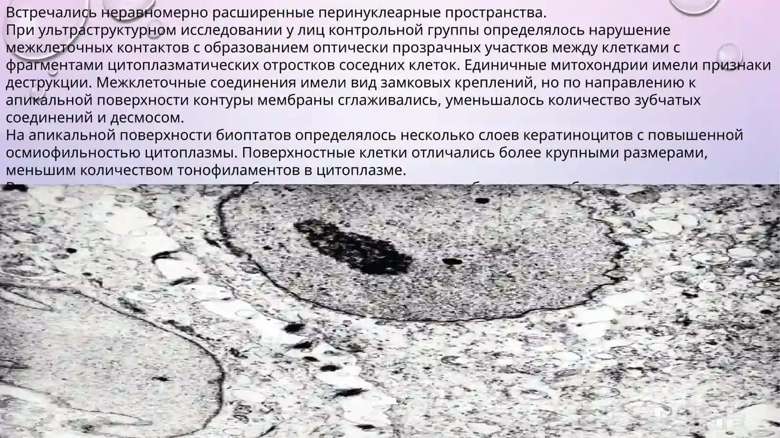Возрастные особенности строения слизистой оболочки полости рта 4