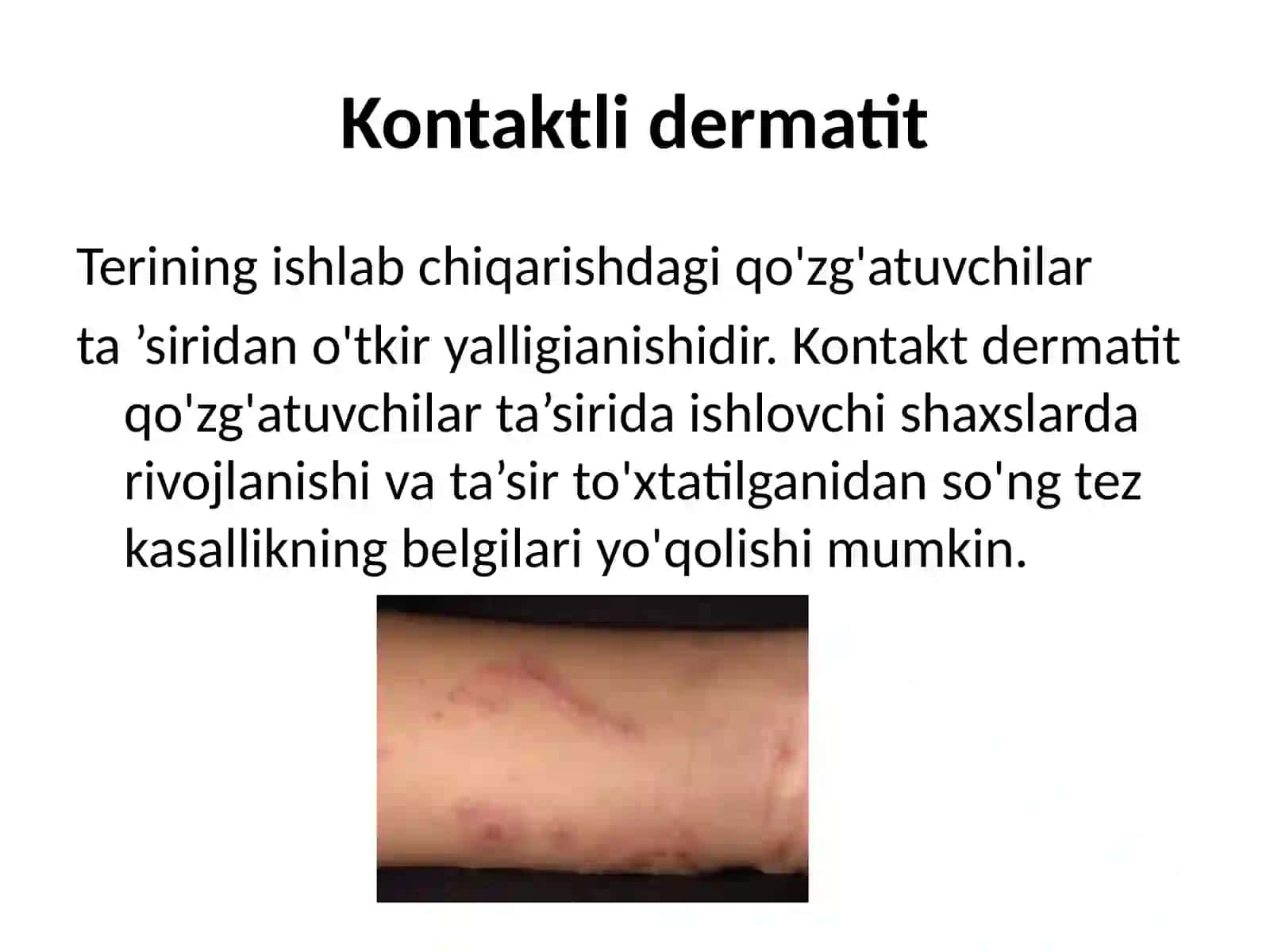 TERINING KASBIY KASALLIKLARI 4